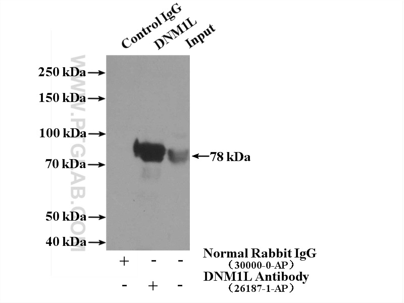 26187-1-AP;mouse brain tissue