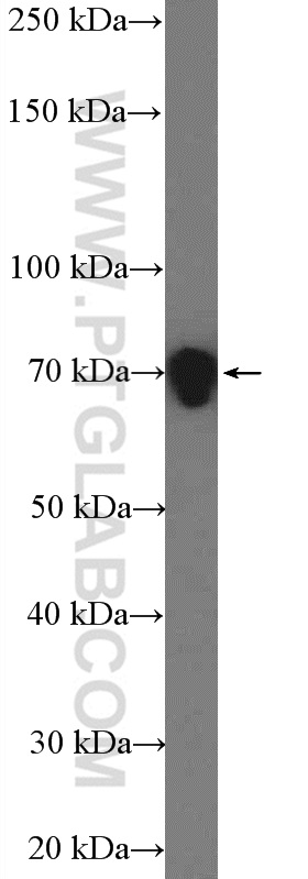 26187-1-AP;mouse brain tissue