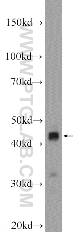 20575-1-AP;HeLa cells