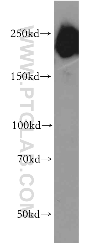 20683-1-AP;human brain tissue