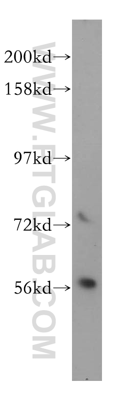 14087-1-AP;Jurkat cell