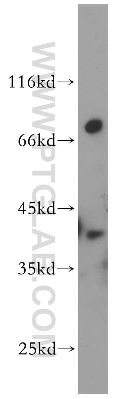 14108-1-AP;mouse brain tissue