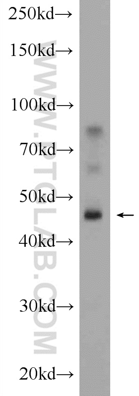 12222-1-AP;mouse liver tissue