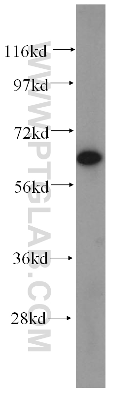 14521-1-AP;human heart tissue