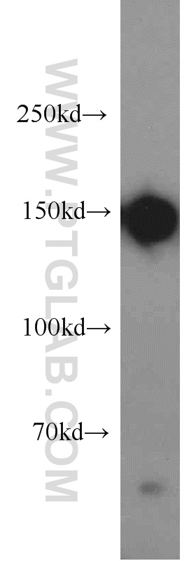 21880-1-AP;HepG2 cell