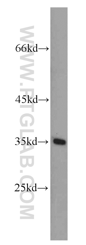 12689-1-AP;MCF7 cell