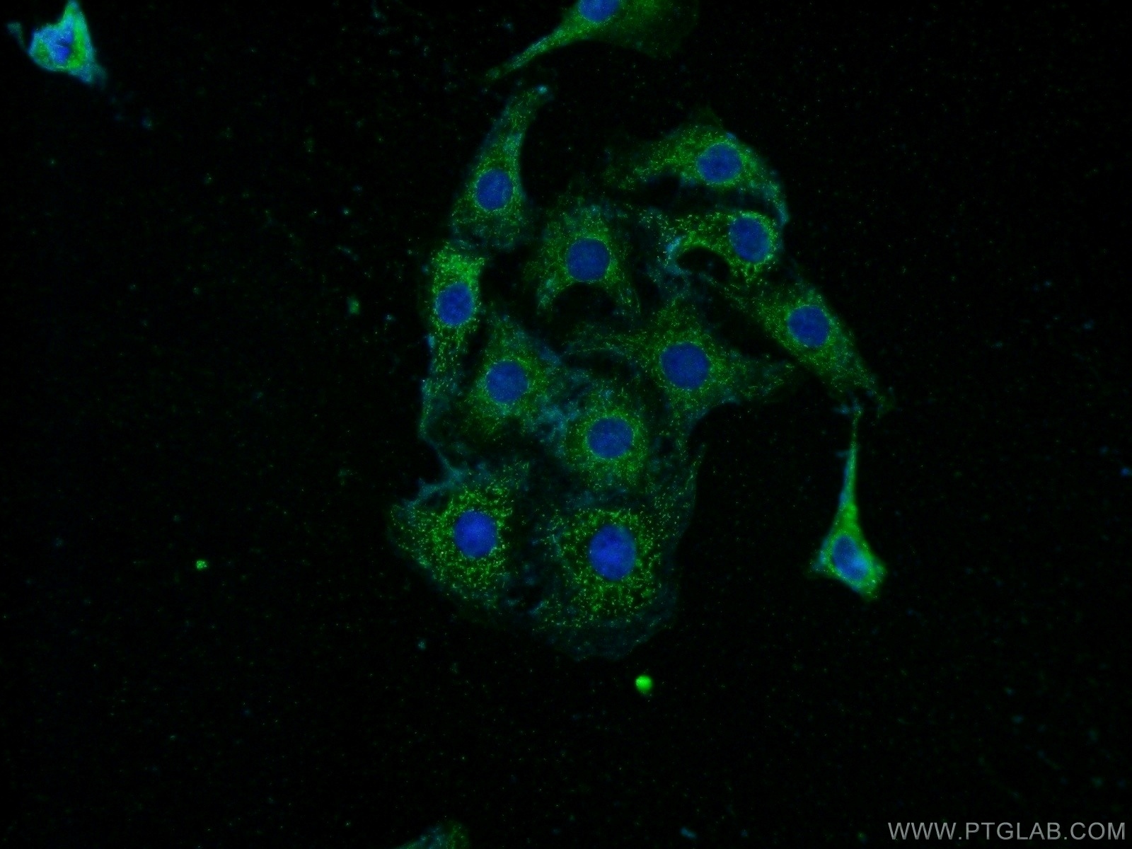 14578-1-AP;SH-SY5Y cells