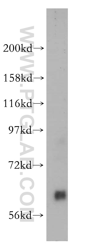 14578-1-AP;human placenta tissue