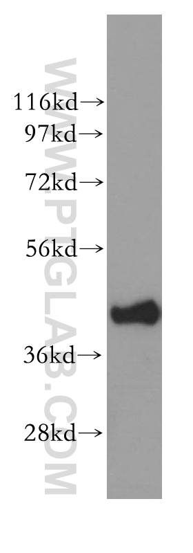 11423-1-AP;mouse uterus tissue