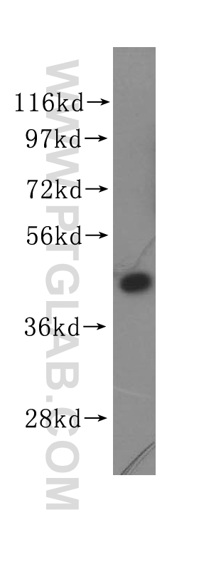 11280-1-AP;Jurkat cells