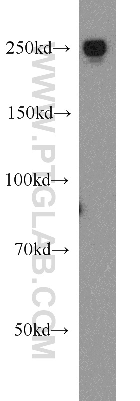 15704-1-AP;HeLa cells