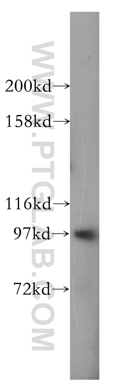 17728-1-AP;MCF7 cells