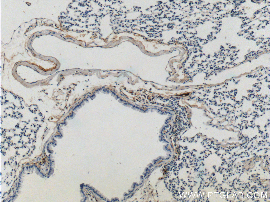 15257-1-AP;mouse lung tissue