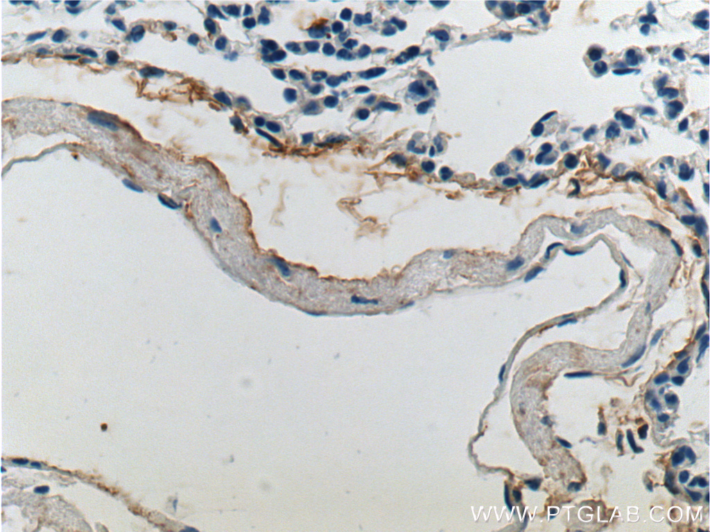 15257-1-AP;mouse lung tissue