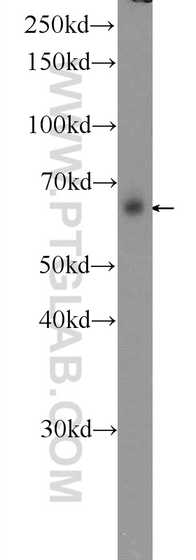 13946-1-AP;HeLa cells