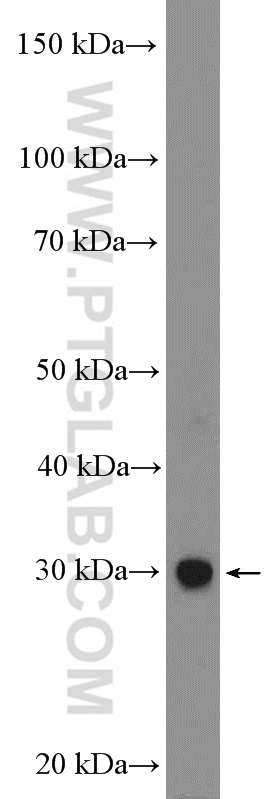 55032-1-AP;mouse brain tissue