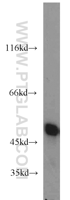 55237-1-AP;HeLa cells