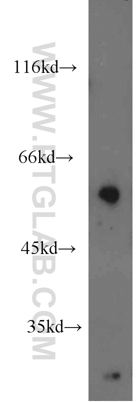 17305-1-AP;HL-60 cell