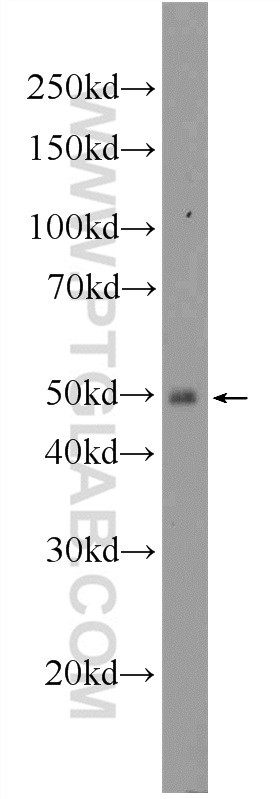 11626-1-AP;mouse spleen tissue