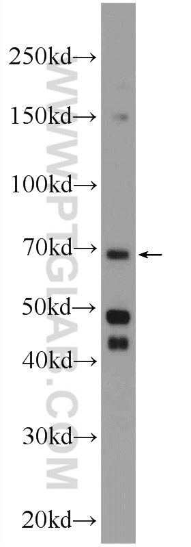 24558-1-AP;HeLa cells