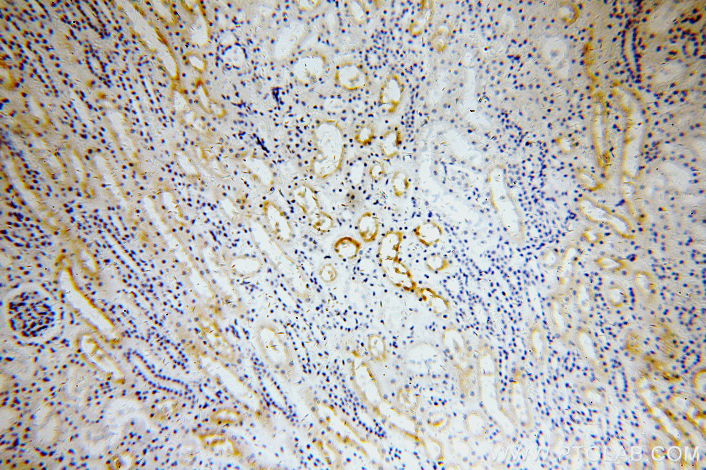 19943-1-AP;human kidney tissue