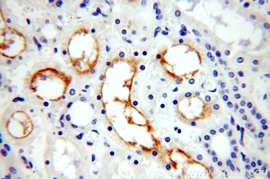 19943-1-AP;human kidney tissue