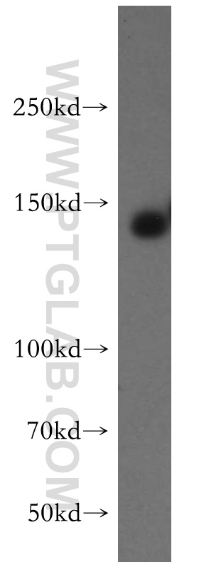 19943-1-AP;mouse brain tissue