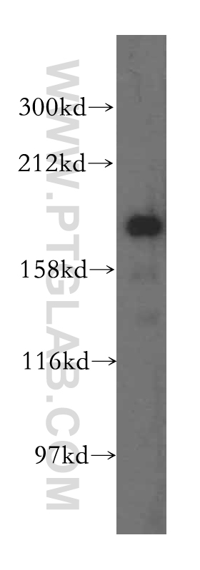 15688-1-AP;human heart tissue