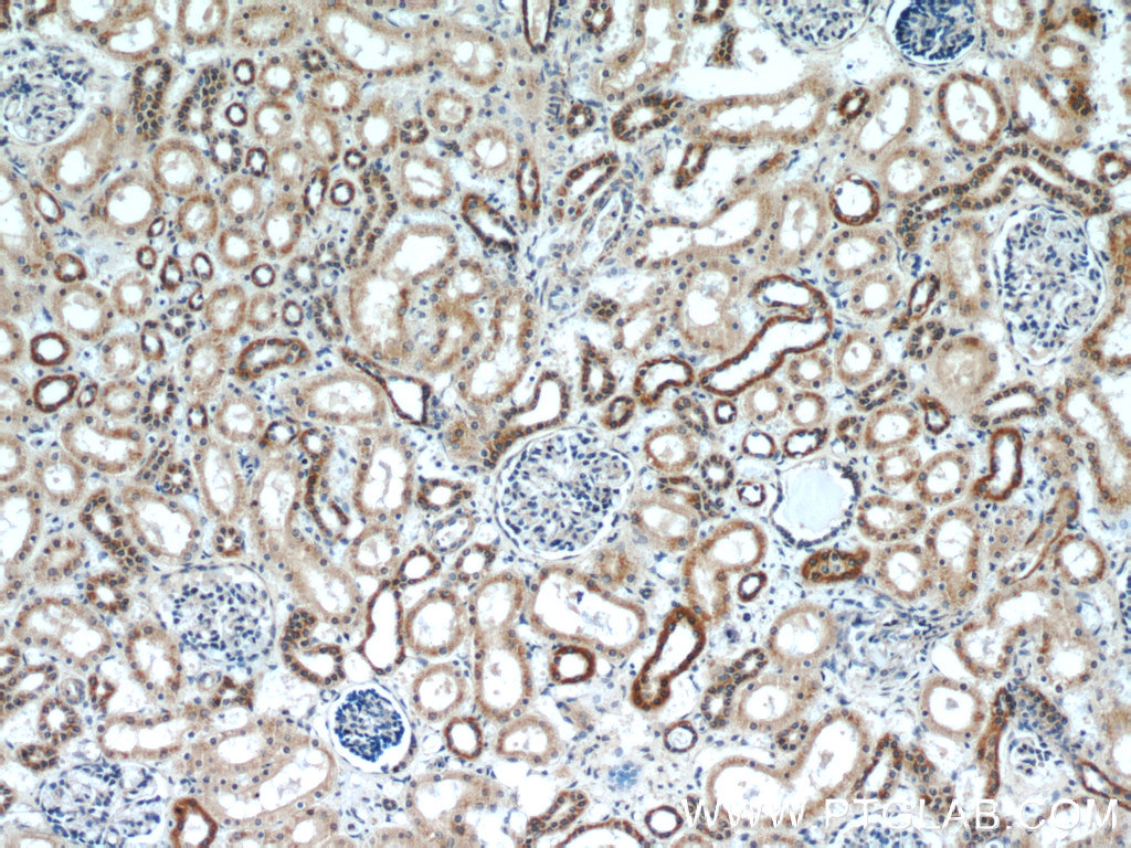 2, map kinase isoform p42, mapk 1, mapk 2, mapk1, mapk2, p40