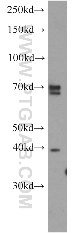 14781-1-AP;HeLa cells