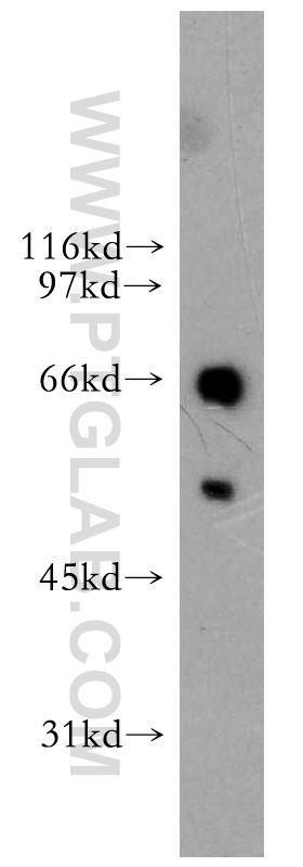 13182-1-AP;A431 cells