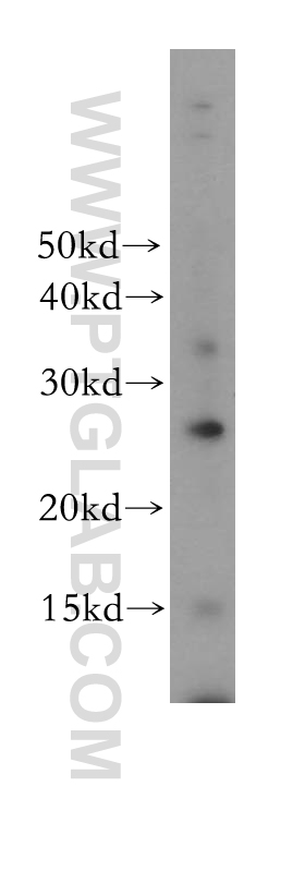 17415-1-AP;human brain tissue