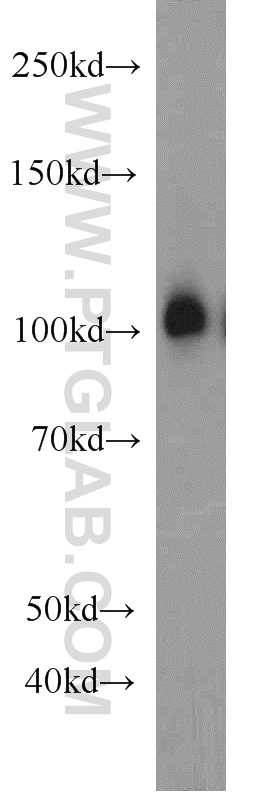 11690-1-AP;rat brain tissue