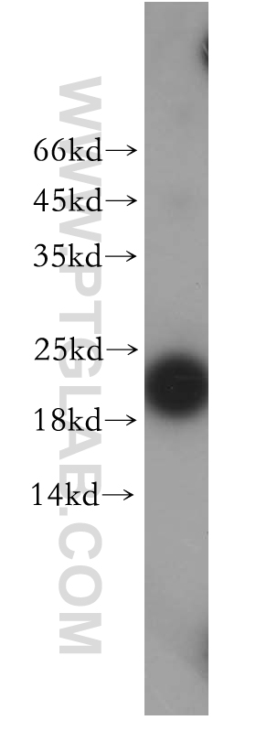 12585-1-AP;SGC-7901 cell