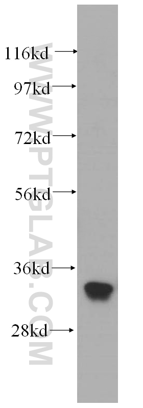 14805-1-AP;HeLa cells