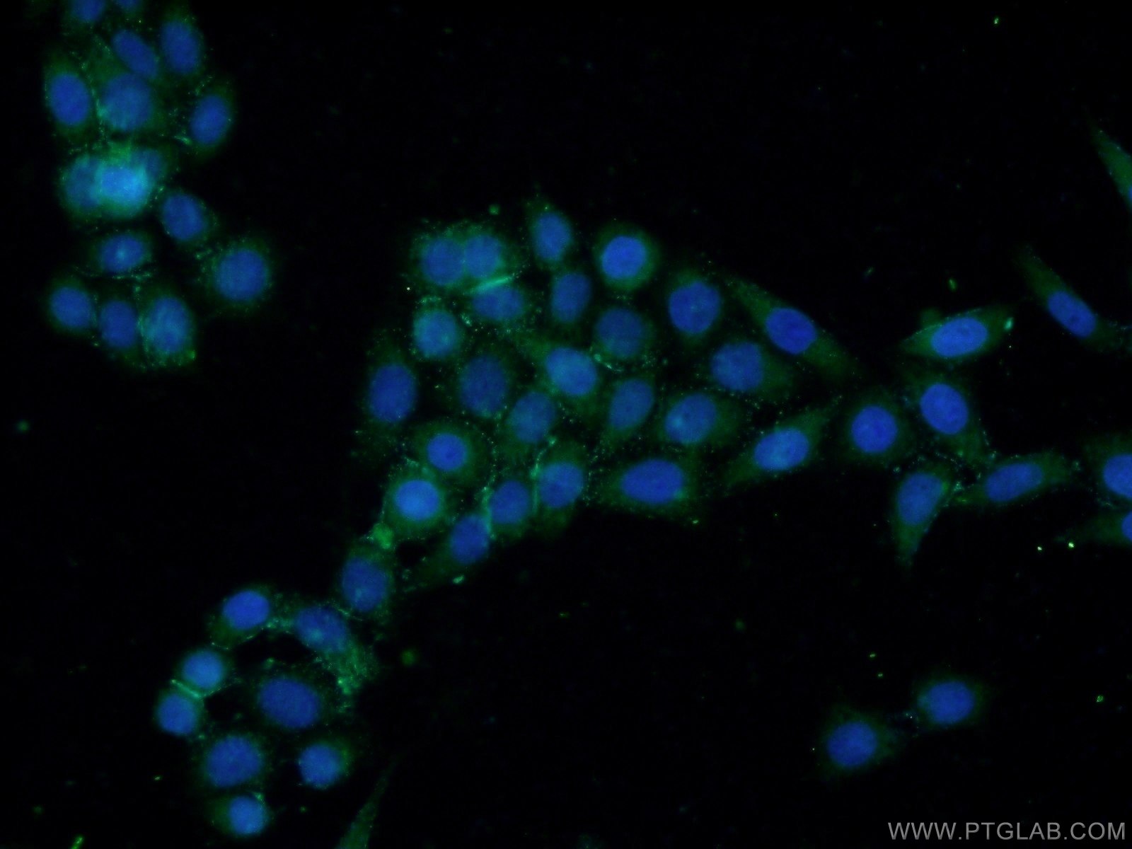 22658-1-AP;HeLa cells