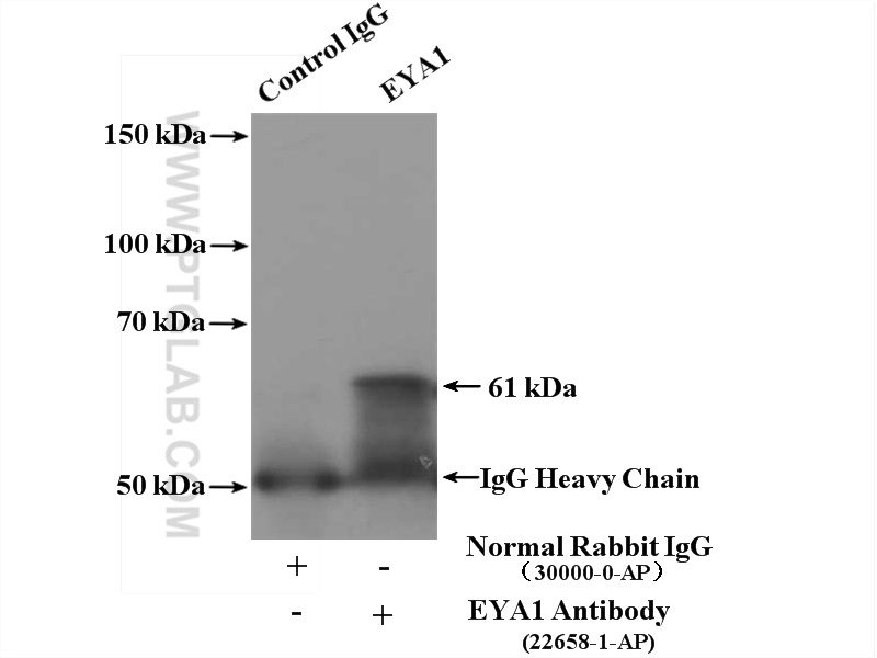 22658-1-AP;mouse kidney tissue