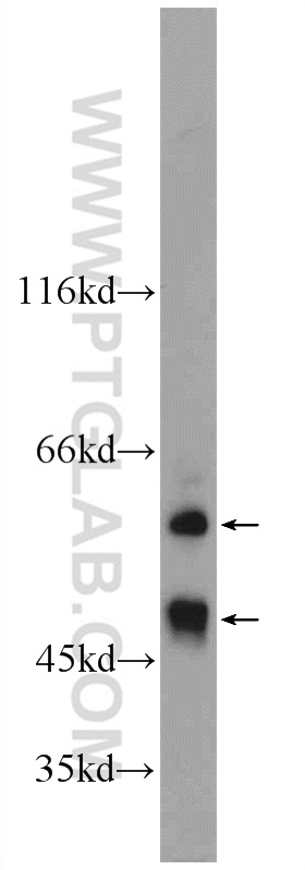 22658-1-AP;mouse kidney tissue