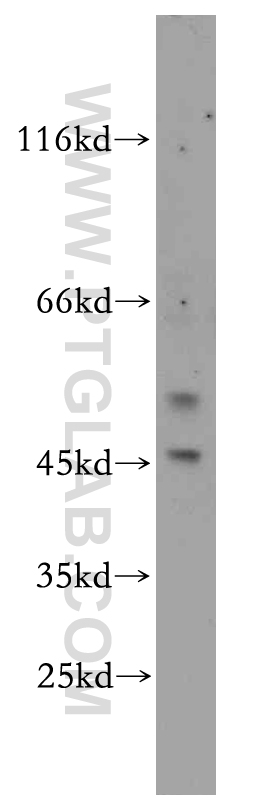 11314-1-AP;HeLa cells