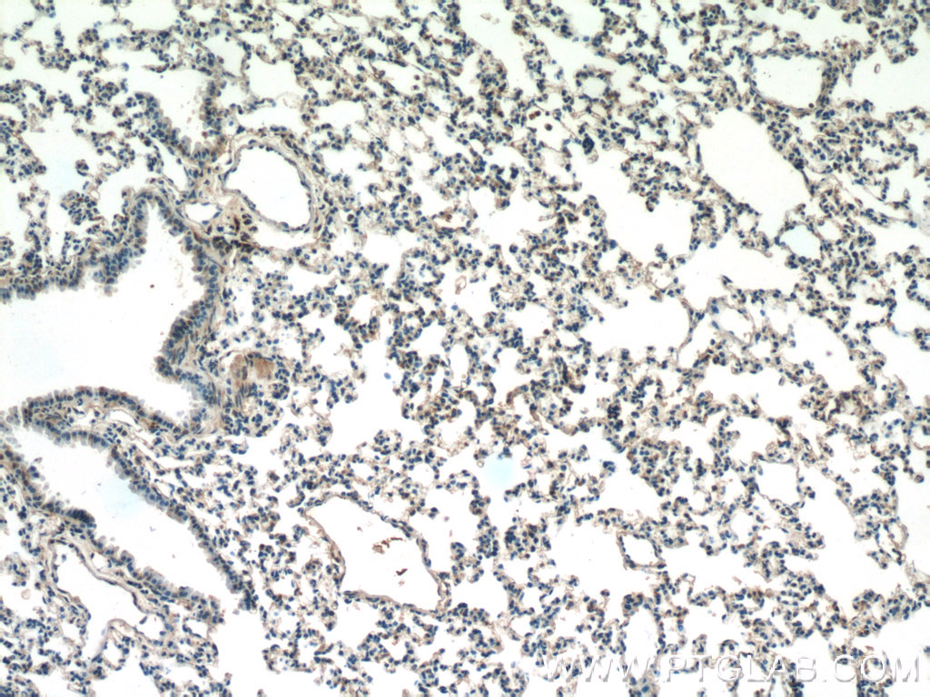 25306-1-AP;mouse lung tissue