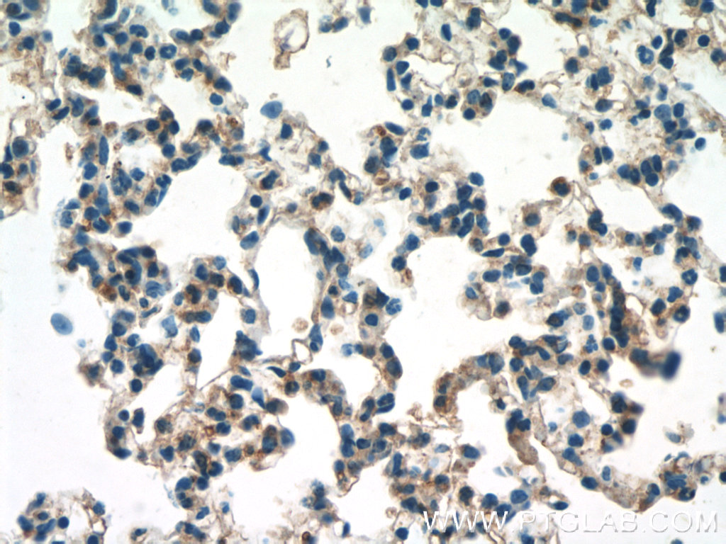 25306-1-AP;mouse lung tissue