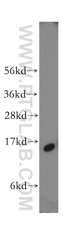 12348-1-AP;human brain tissue