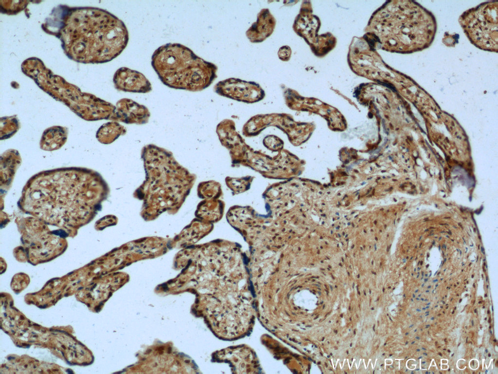 25668-1-AP;human placenta tissue