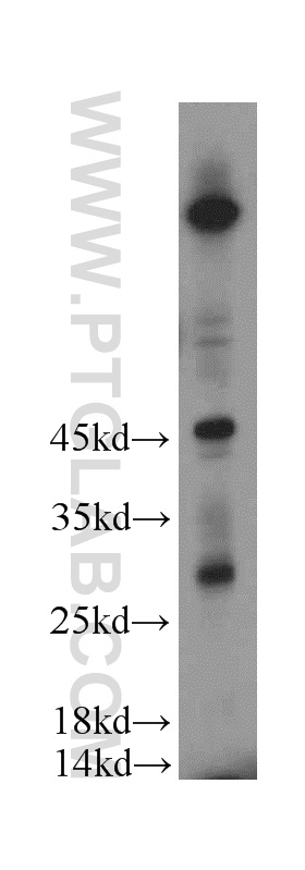 20911-1-AP;HeLa cell