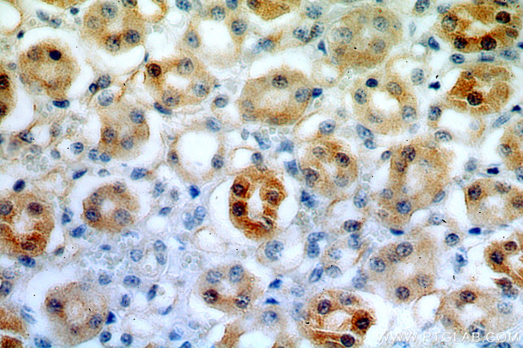 20108-1-AP;H-kidney