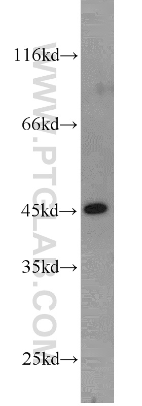 13349-1-AP;HepG2 cells