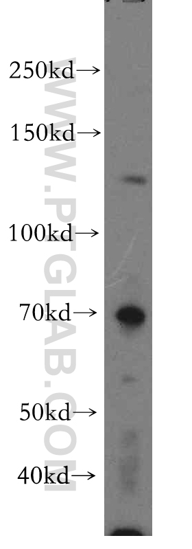 14275-1-AP;PC-3 cell