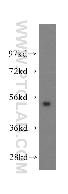 11161-1-AP;human liver tissue