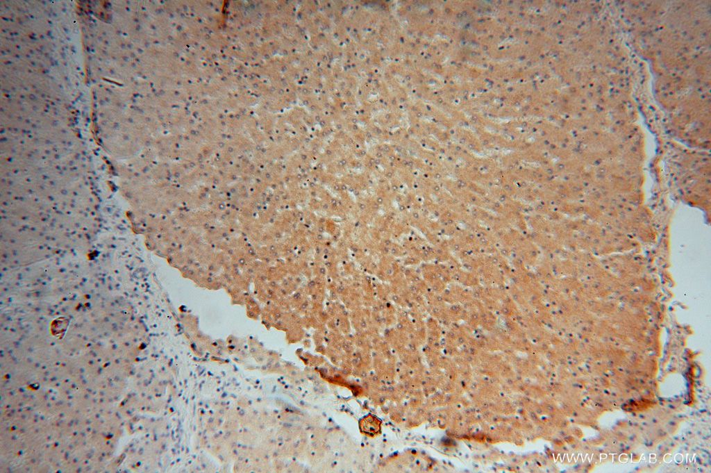 15584-1-AP;human liver