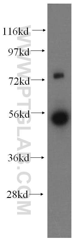 15584-1-AP;human adrenal gland tissue